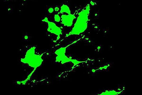 © Zilentix: Keine moderne Kunst, sondern eine mikroskopische Aufnahme von absterbenden Tumorzellen © Zilentix: No modern art, but a microscopic picture of dying off tumor cells